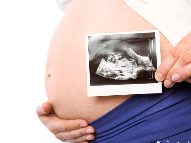 mother with her scan picture